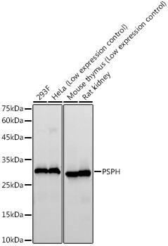 Phosphoserine phosphatase Antibody (1J5O2)