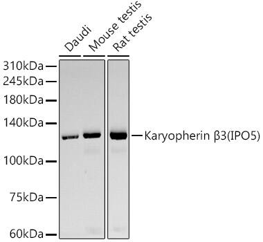 Karyopherin (importin) beta 3 Antibody (10K10W2)