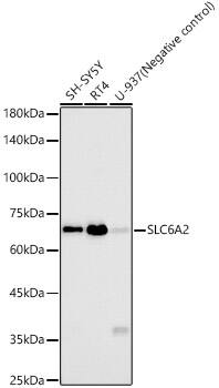 SLC6A2/NET/Noradrenaline transporter Antibody (6F7V1)