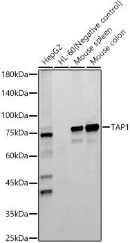 TAP1 Antibody (6Q8Q5)