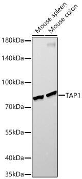 TAP1 Antibody (6Q8Q5)