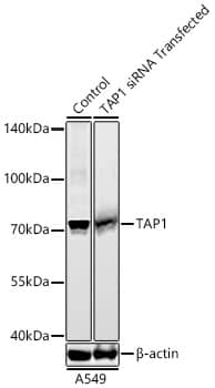 TAP1 Antibody (6Q8Q5)