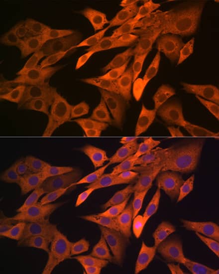 SRP54 Antibody (1O3J1)