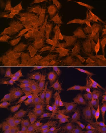 SRP54 Antibody (1O3J1)