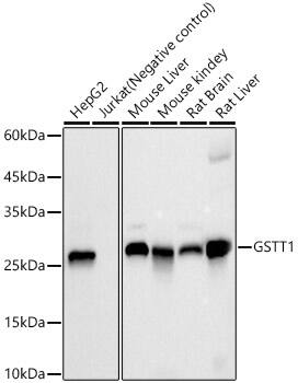 GSTT1 Antibody (2A7N6)