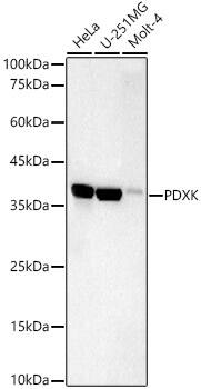 Pyridoxal Kinase/PDXK Antibody (5N4M3)