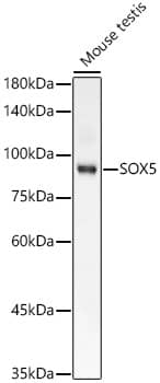 SOX5 Antibody (7W1J1)