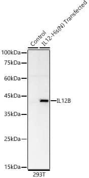 IL12B Antibody (3F3S0)