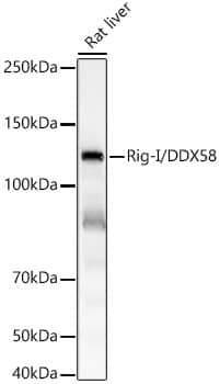 RIG-I Antibody (3E1C6)