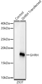 GHRH Antibody (8G5Y9)