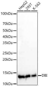 ACBP Antibody (2N0A7)