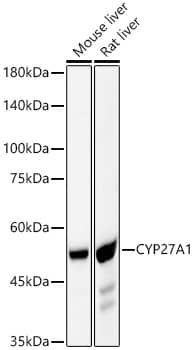 CYP27A1 Antibody (6L9D1)