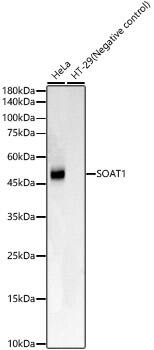 SOAT1 Antibody (8J8E6)