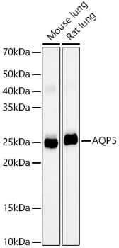 Aquaporin-5 Antibody (10V2Y1)