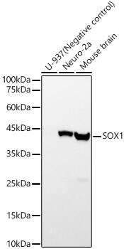 SOX1 Antibody (0H4C1)