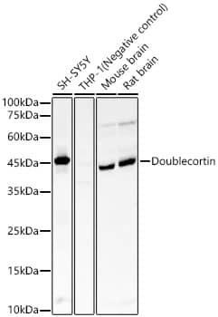 Doublecortin Antibody (5F9B2)