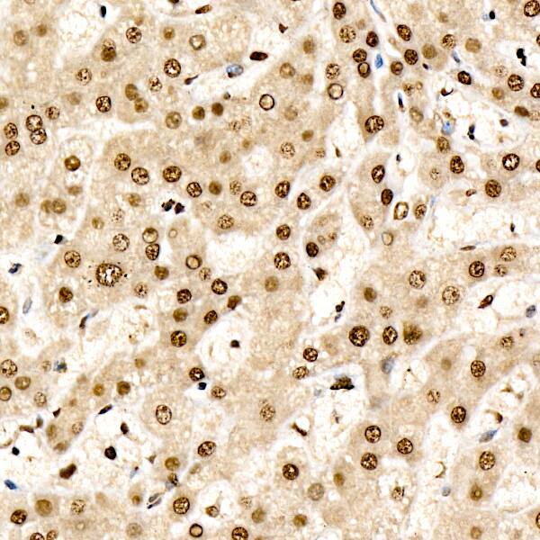 CHD4 Antibody (0M3R5)