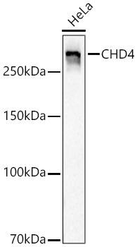 CHD4 Antibody (0M3R5)