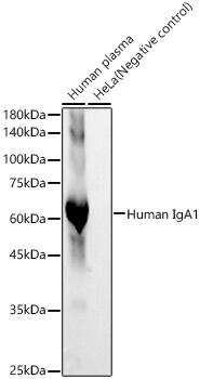 IgA1 Antibody (6N7H1)