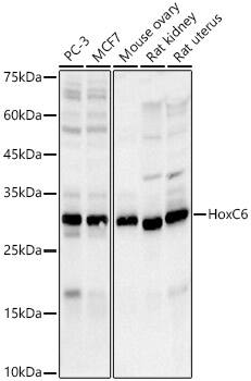 HOXC6 Antibody (8H7N8)