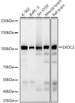 EXOC2 Antibody (5S2X9)