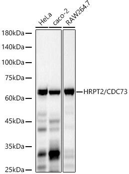 CDC73/HRPT2 Antibody (1B8Q1)