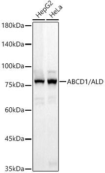 ABCD1 Antibody (9R4O8)