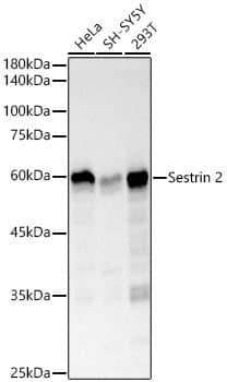 SESN2 Antibody (8I1W4)