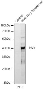 Pejvakin Antibody (10R1X6)