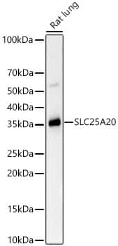 SLC25A20 Antibody (3J1L5)