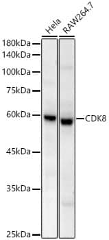 CDK8 Antibody (2P3P8)