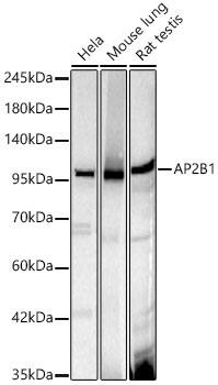 Beta 2 Adaptin Antibody (9W4U6)