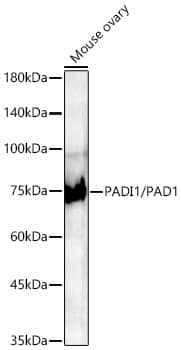 PADI1 Antibody (8M9P3)