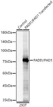 PADI1 Antibody (8M9P3)