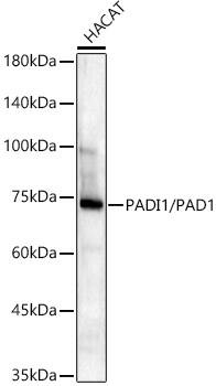 PADI1 Antibody (8M9P3)