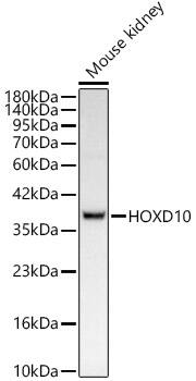 HOXD10 Antibody (5H5S6)