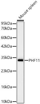 PHF11 Antibody (1J3E4)