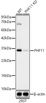 PHF11 Antibody (1J3E4)