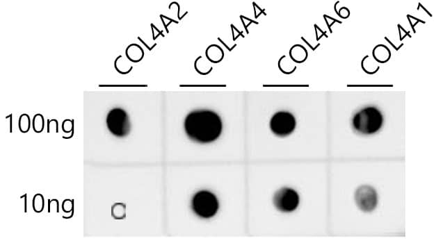 Collagen IV Antibody (3V3N3)