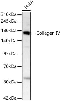 Collagen IV Antibody (3V3N3)