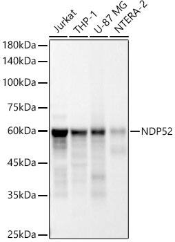NDP52 Antibody (10Q0T10)