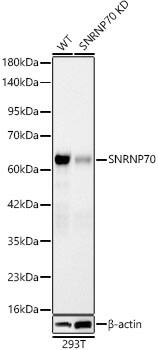 SNRP70 Antibody (2W1C8)