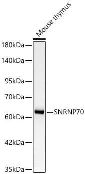 SNRP70 Antibody (2W1C8)
