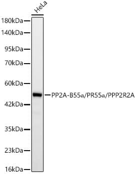 PPP2R2A Antibody (9E5N2)