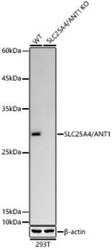 Adenine Nucleotide Translocase 1 Antibody (1U7X1)