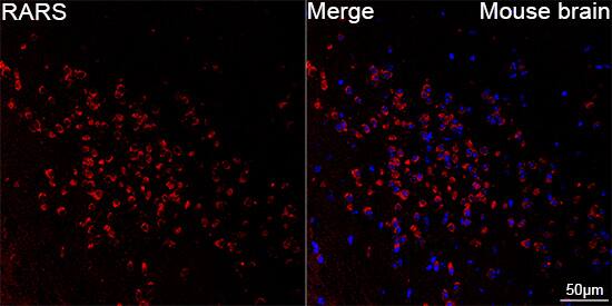 Arginyl tRNA synthetase Antibody (4Y1H4)