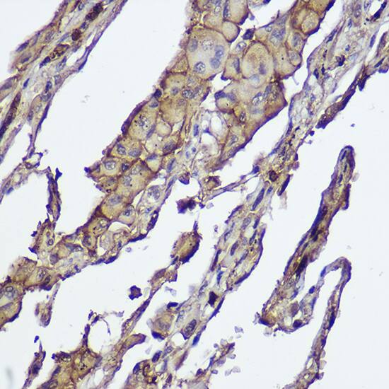 AKT1/2 Antibody (1G0K5)