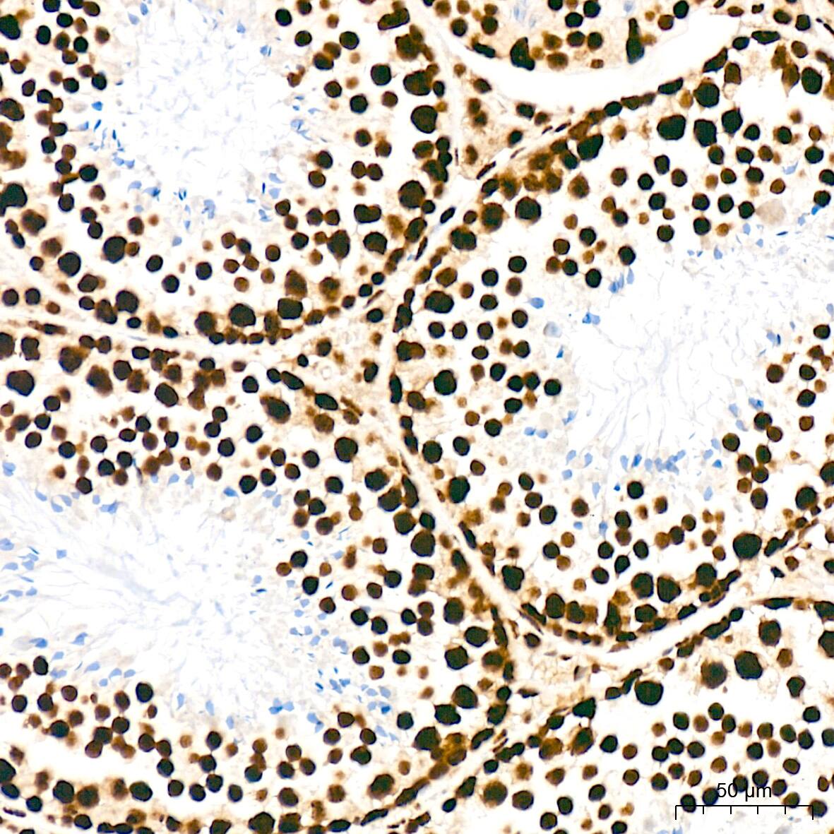 SFPQ Antibody (8Y5S6)