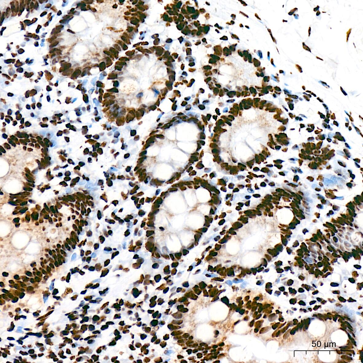 SFPQ Antibody (8Y5S6)