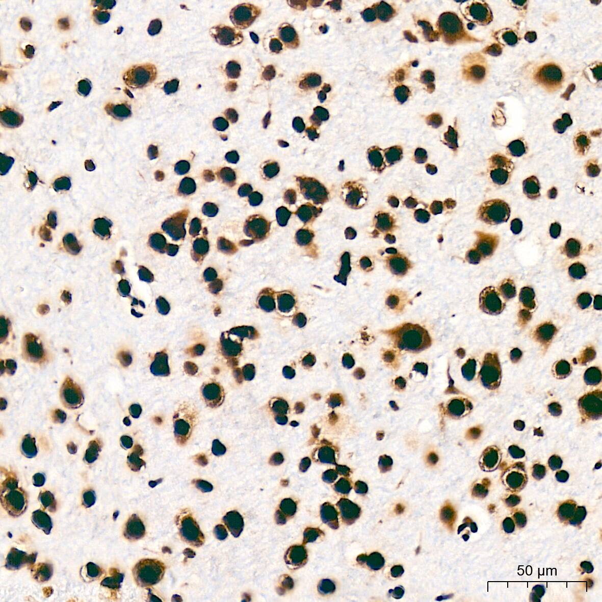 SFPQ Antibody (8Y5S6)